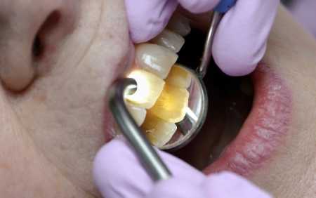 Price gap increases in dental services