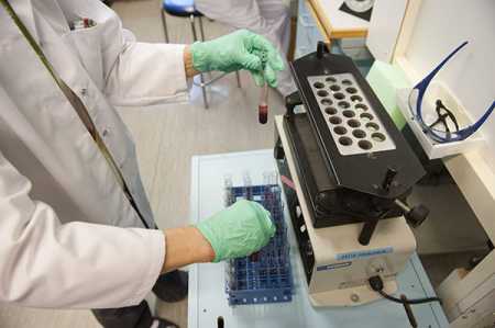 20 exposed to HIV thru unsterilized needles